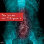 Chippewa Falls (Lake Hallie) - Disc Issues and Chiropractic