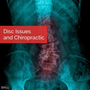 Chippewa Falls (Lake Hallie) - Disc Issues and Chiropractic